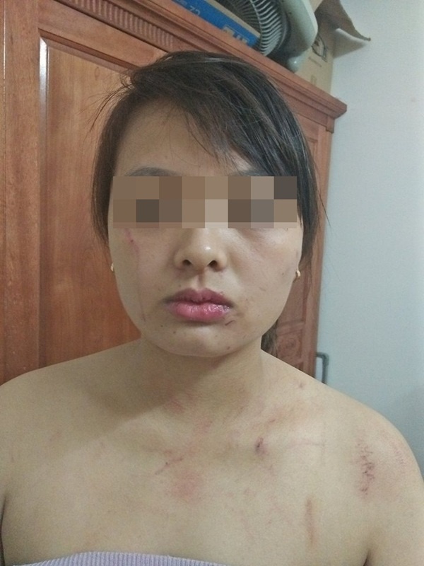 nang dau bat hanh nhat the gioi bi danh bam nguoi vi khong chiu dua het tien luong