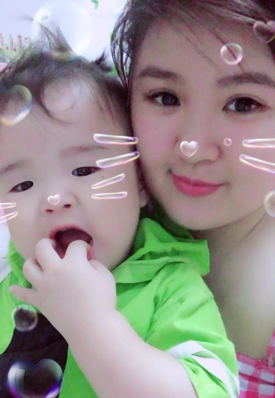 u benh 10 ngay be trai 20 thang duoc phat hien mac tay chan mieng nang nhat benh vien