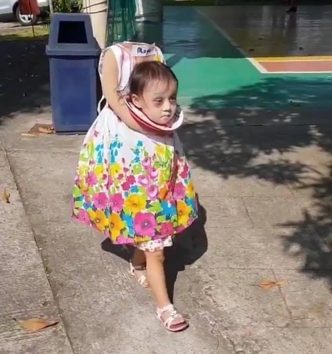 Vượt xa các loại ma quỷ, cô bé ôm đầu đi xin kẹo gây bão MXH mùa Halloween vuot xa cac loai ma quy co be om dau di xin keo gay bao mxh mua halloween