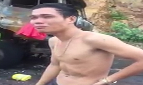 hoi cua benh lau lai tai phat mot lan