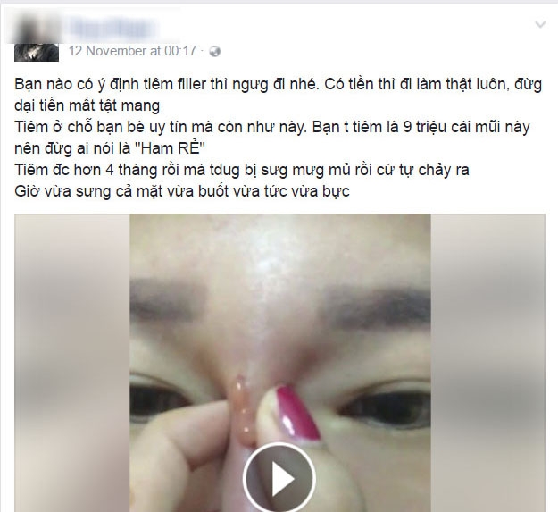 hau qua cua viec tiem chat lam day troi noi
