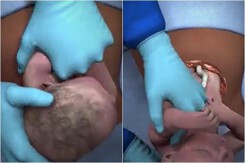 Xem xong clip này, nhiều người sẽ biết vì sao sinh mổ lại đáng sợ đến vậy