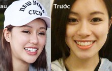 Cô gái xinh đẹp hối hận sau 30 lần thủ thuật để vừa ý bạn trai