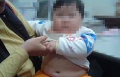 Bé béo phì - lớn thấp lùn