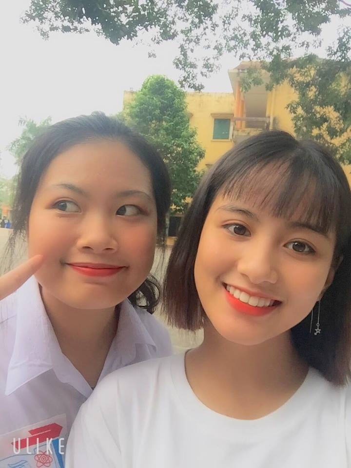 khong thich rang khenh co gai nieng rang va ket qua bat ngo