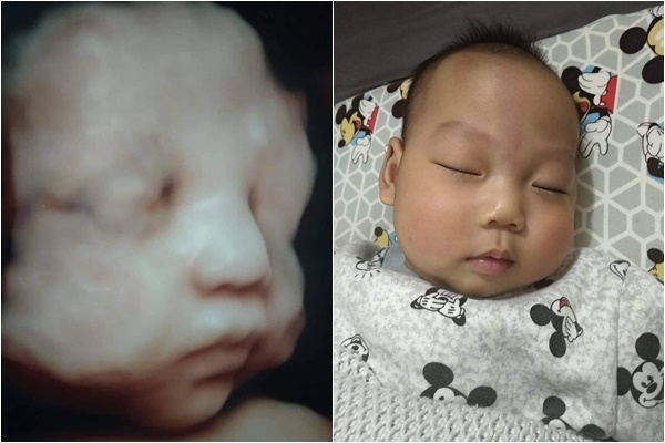 bi bac si khuyen dinh chi thai ki ba me ha noi quyet giu con va dieu ki dieu den bat ngo