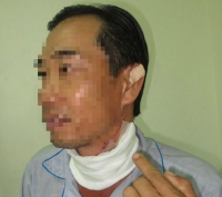 vo tinh hon mop duoi xe tai xe xe khach de lai loi nhan gay bat ngo