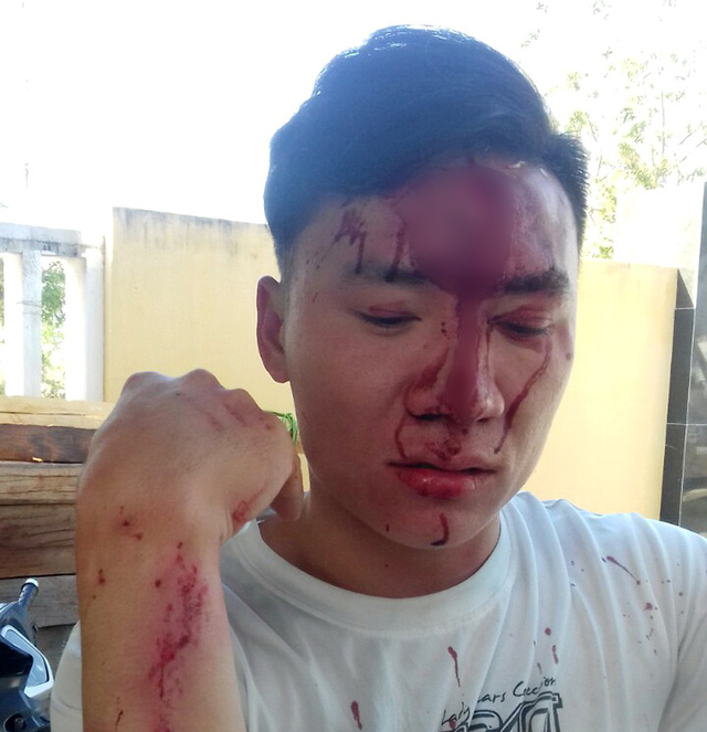 mot can bo kiem lam nghi bi lam tac danh thung tran