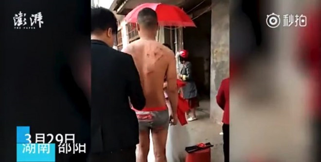 chu re bi danh dap xat muoi vet thuong vi hu tuc dam cuoi