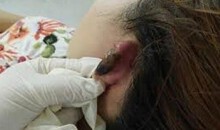 Cô gái bị chích điện, xẻo tai vì chậm trả 20 triệu đồng