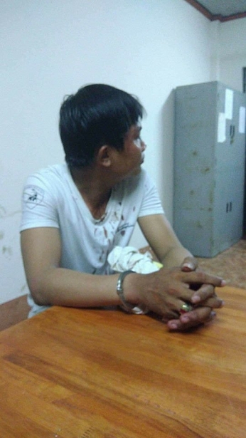 bi do nong do con nam thanh nien chem gan dut ngon tay canh sat