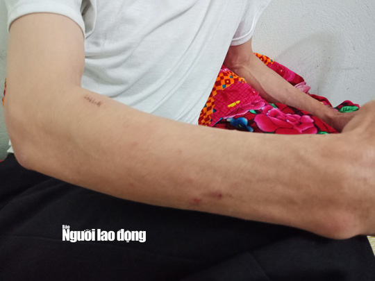 tai xe taxi mai linh bi danh nhap vien len tieng