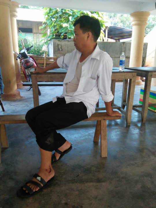 khi duoi lon tan cong lam bi thuong trung ta cong an