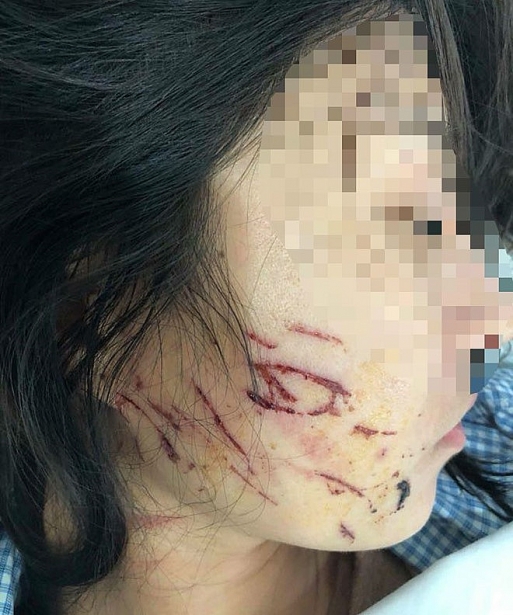 tin nong trong ngay 146 co gai khong cap bo van bi doi nuoc mam cong an di lam nhiem vu bi tat nuoc phan