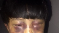 nghi pham bao hanh be 4 tuoi tu vong khai gi