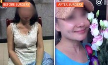 'Chúa Chổm' 60 tuổi phẫu thuật thành thiếu nữ đôi mươi để trốn nợ