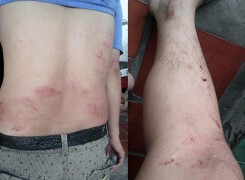 Vụ công văn đe dọa VTV9: Người trả lời trên truyền hình bị đánh