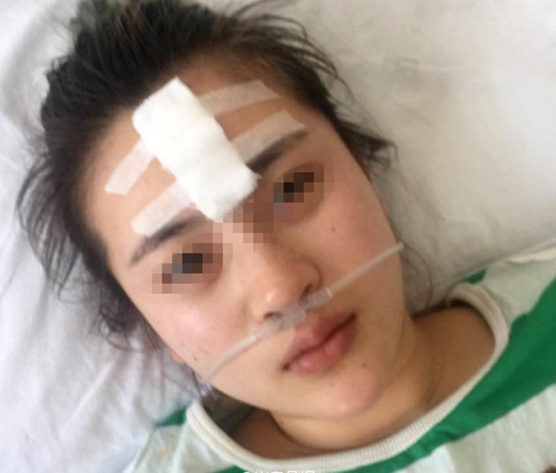 Hậu quả khôn lường khi làm đẹp tại các cơ sở thẩm mỹ chui hau qua khon luong khi lam dep tai cac co so tham my chui