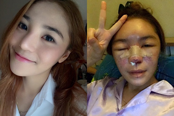 ban co biet phau thuat tham my va nhung rui ro