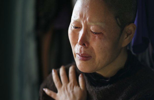 ban co biet phau thuat tham my va nhung rui ro