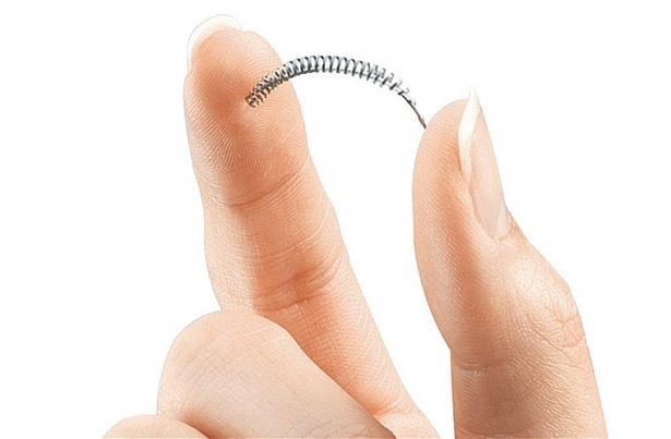 thiet bi tranh thai essure buoc ngung ban tren thi truong