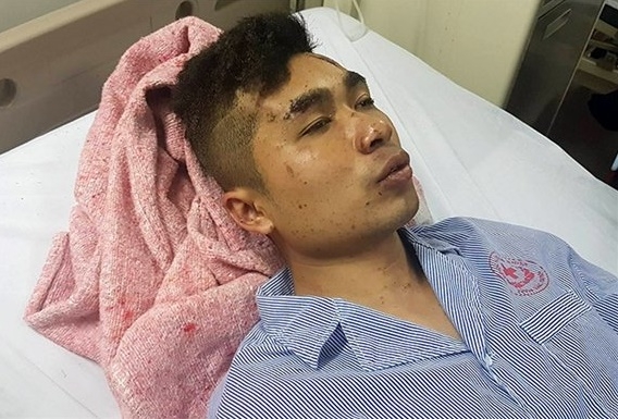 nan nhan vu xe khach giuong nam phat no bang hoang ke lai giay phut gap nan