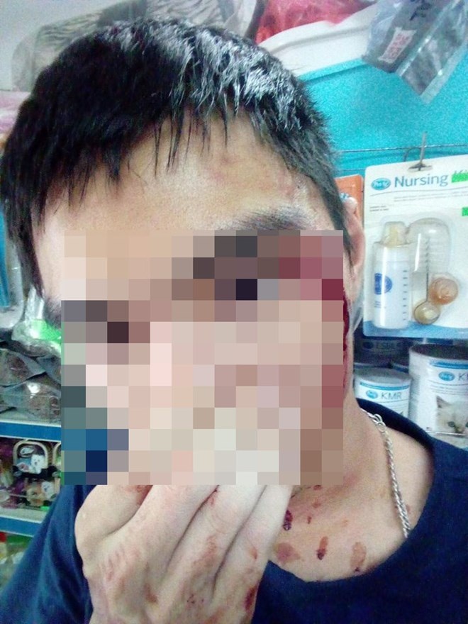 grab phan hoi nghi van tai xe danh nguoi vi khong nhuong duong