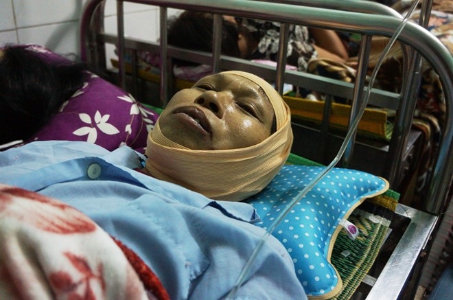 xac dinh nguyen nhan ban dau vu no lo hoi o thai binh
