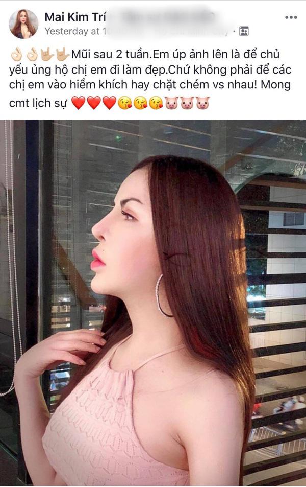 sau bien chung nao silicone hot girl chuyen gioi trieu followers tiep tuc khoe anh sua mui