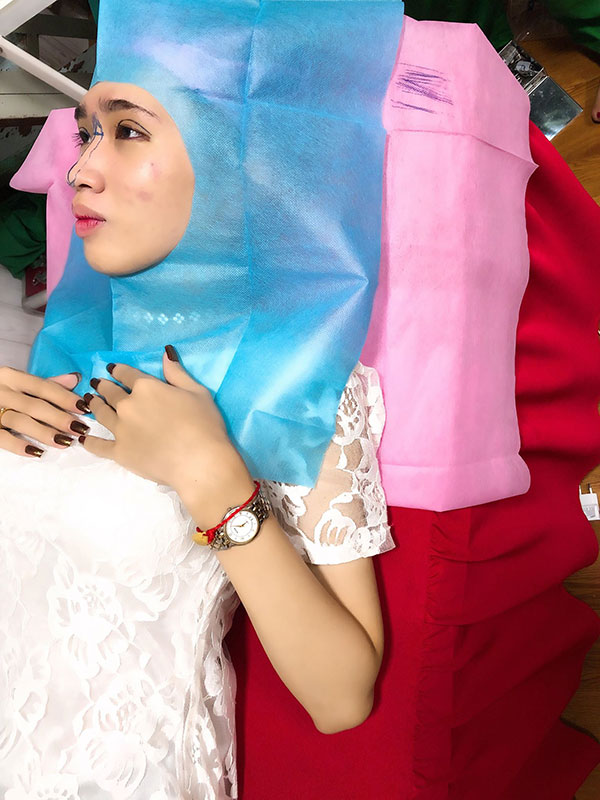 co gai trong than xac nam nhi phau thuat toan bo guong mat de nu tinh hon