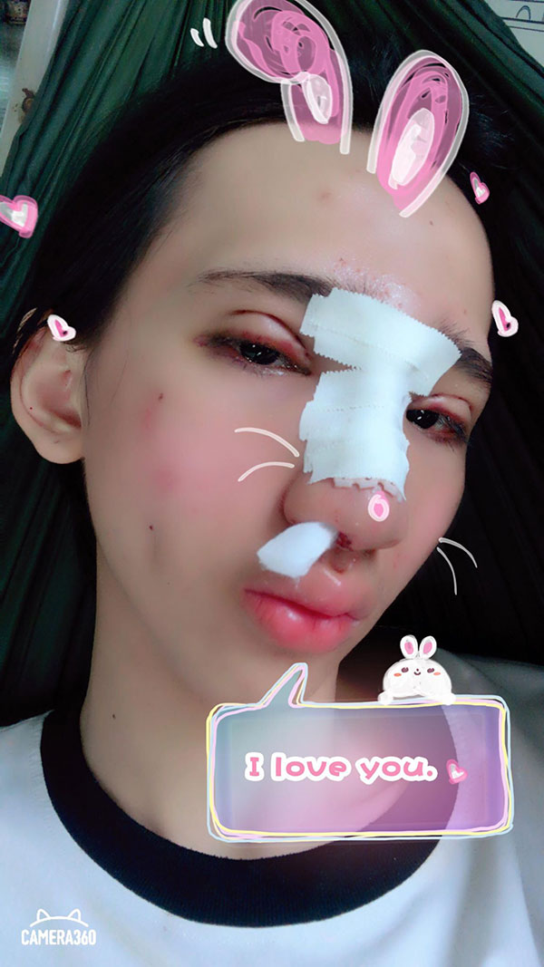 co gai trong than xac nam nhi phau thuat toan bo guong mat de nu tinh hon