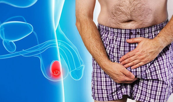 5 dấu hiệu nguy hiểm cảnh báo bệnh ung thư tinh hoàn mà nam giới thường bỏ qua 5 dau hieu nguy hiem canh bao benh ung thu tinh hoan ma nam gioi thuong bo qua