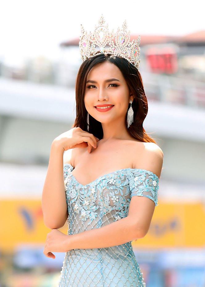 hoa hau chuyen gioi dau tien hoi han ve cuoc phau thuat dinh menh