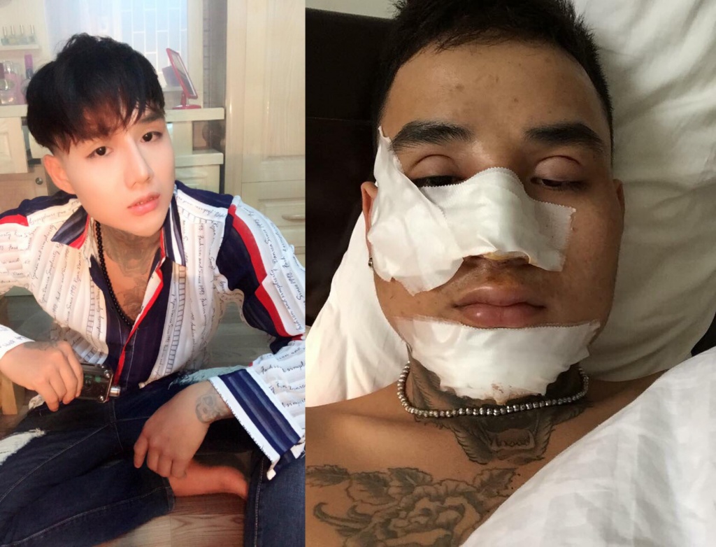 hotface bao quoc phau thuat tham my 16 lan nhung de dep va tu tin hon thi toi van muon thuc hien