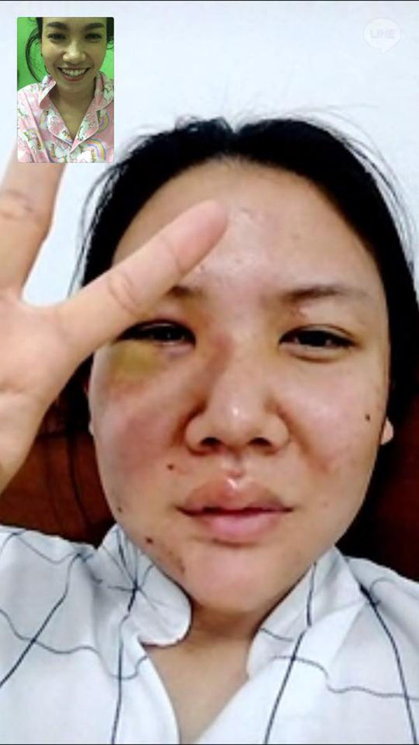 7 nam yeu co gai bi ban trai dong tinh danh dap tan nhan mat bien dang