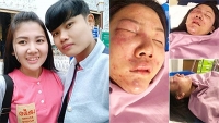 lai phat hien them cap dong tinh nu dep ca doi khien cu dan mang phat sot