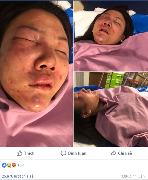 da bat duoc tomboy dong tinh danh dap nguoi yeu da man sau 7 nam yeu