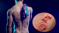 man cau hon cua cap dong tinh nam dien trai khien cu dan mang phat sot
