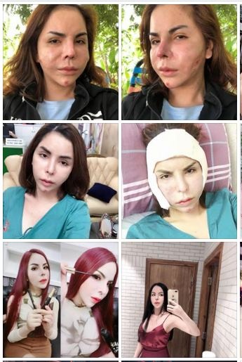 hotgirl chuyen gioi linda gay bao mang vi khuon mat di dang meo mo