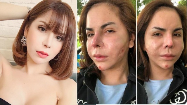 khong chi hotgirl chuyen gioi linda day la loat nan nhan cua loi dao keo hong