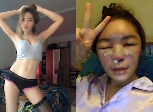khong chi hotgirl chuyen gioi linda day la loat nan nhan cua loi dao keo hong