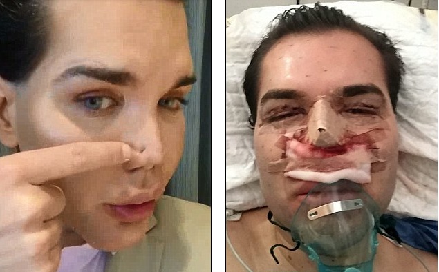 khong chi hotgirl chuyen gioi linda day la loat nan nhan cua loi dao keo hong