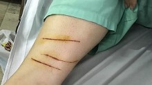 Gia đình nữ sinh bị đe dọa cắt gân