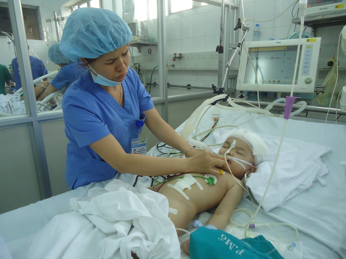 bi tivi roi trung dau be trai 22 thang tuoi chan thuong so nao nguy kich