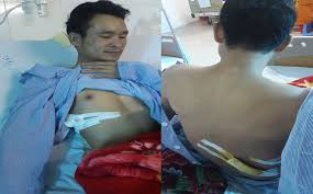 xu ly nghiem doi tuong dam nguoi thanh nien dua co gai bi tai nan di cap cuu