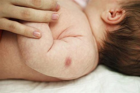 cha me can luu y khi tre bi bien chung sau tiem vaccine