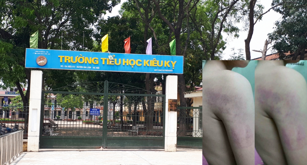 da co quyet dinh hinh thuc ki luat co giao danh tim tay hoc sinh lop 1