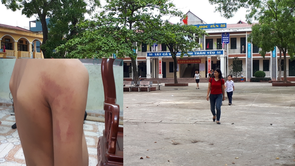 ban giam hieu chi den tham hoi co giao danh moi la nguoi phai xin loi chau t