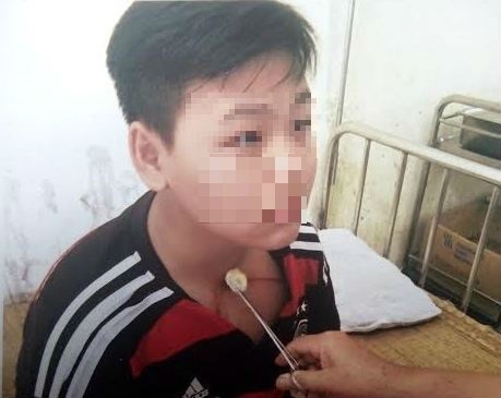 thanh hoa thay giao bi to danh hoc sinh lop 8 chay mau