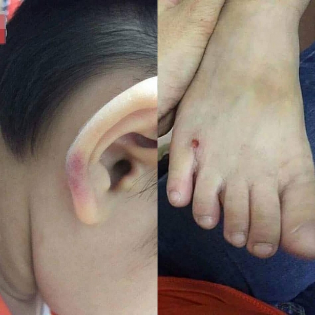 ha noi co giao mam non danh con rieng cua chong nhap vien